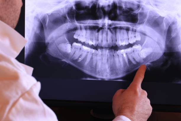 Best Weekend Emergency Dentist in Sharonville, OH